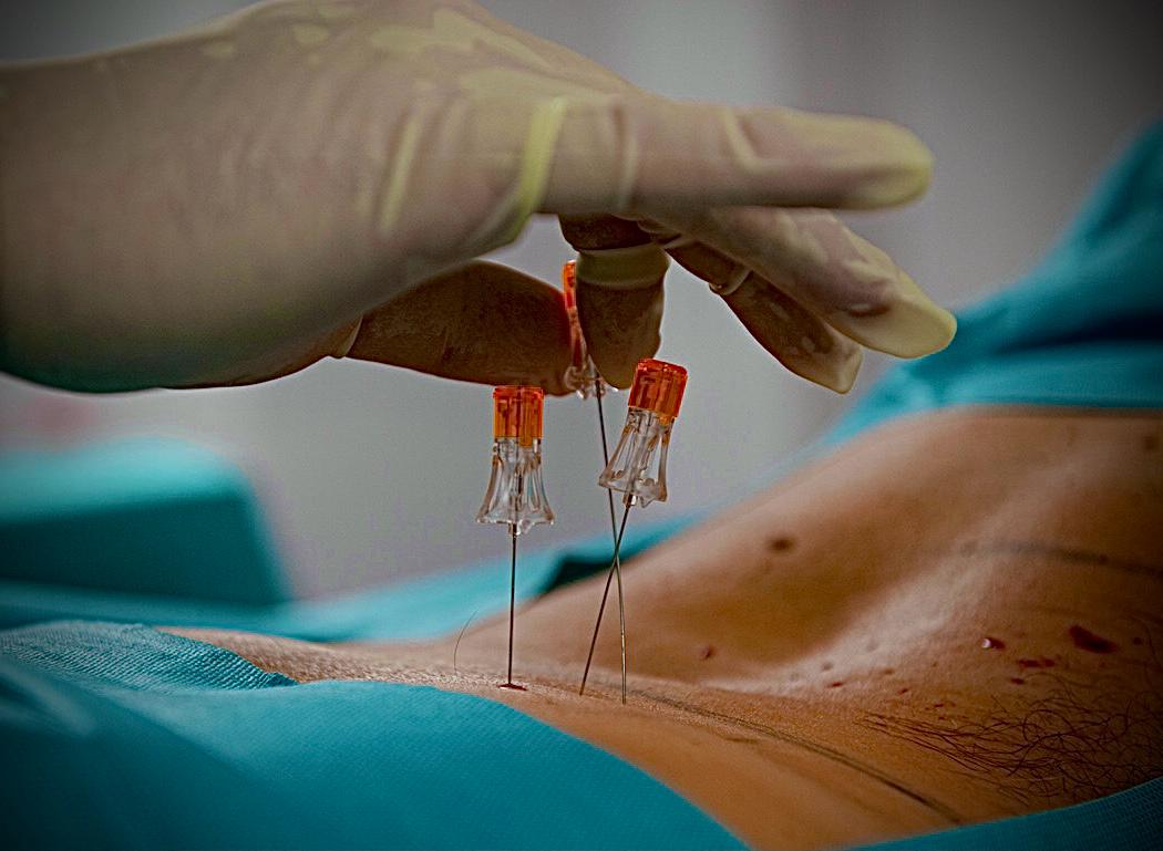 Professor Pawel Nauman Neurochirug 5jpg