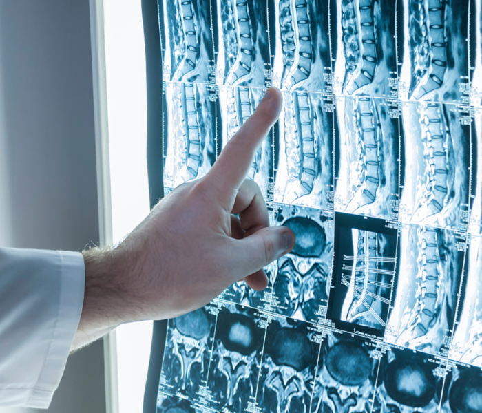 lmc neurochirurgia warszawa blokady unerwien stawow lmc neurochirurgia warszawa blokady unerwien stawow