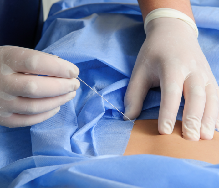 neurochirurgia warszawa blokady unerwien stawow lmc neurochirurgia warszawa blokady unerwien stawow lmc