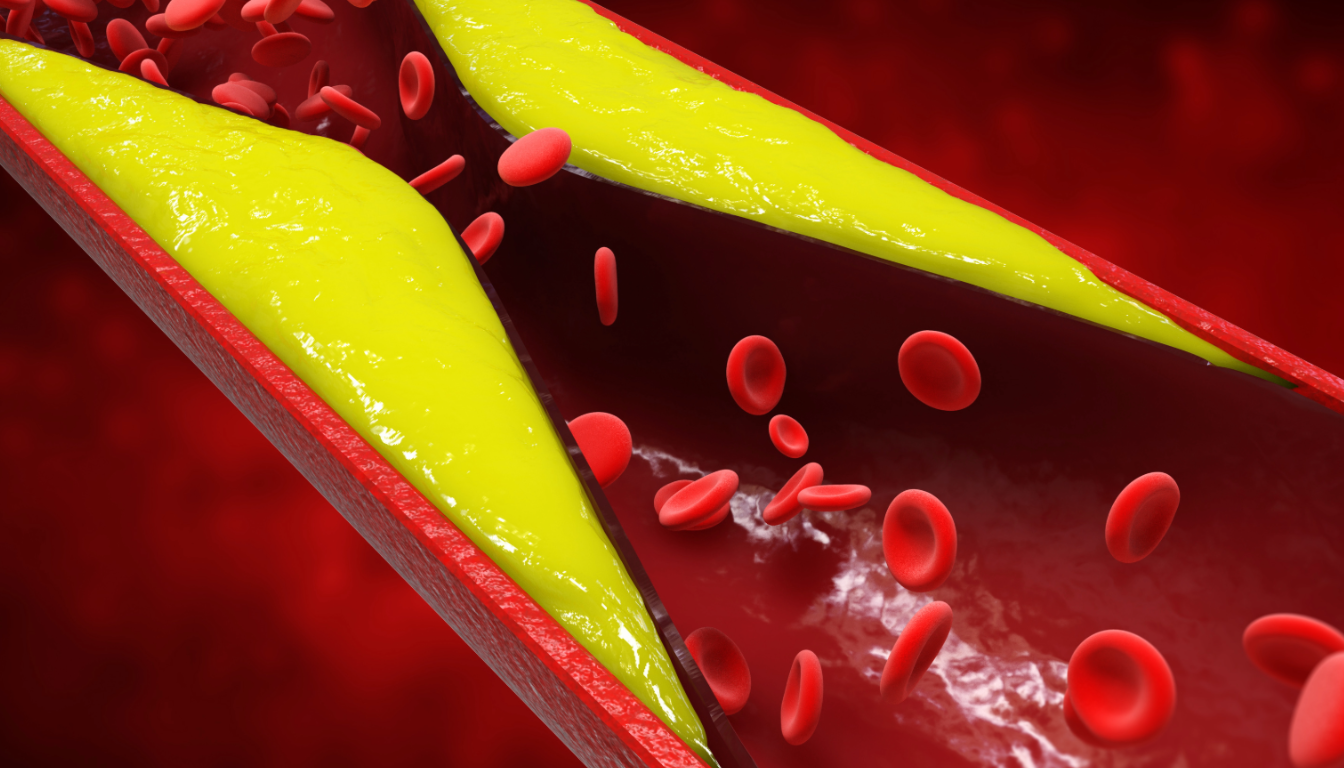 Jak obniżyć cholesterol LDL? Ile trwa leczenie i co jeść | LIFE Medical Center 1 jak obnizyc cholesterol WARSZAWA LIFE MEDICAL CENTER (1)